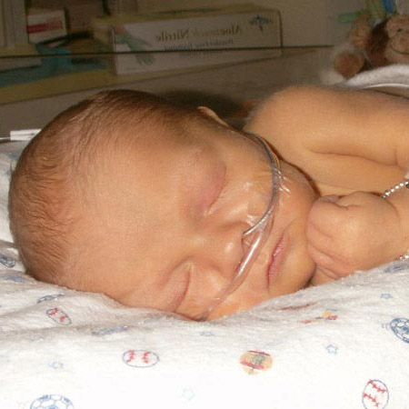 Benjamin in NICU